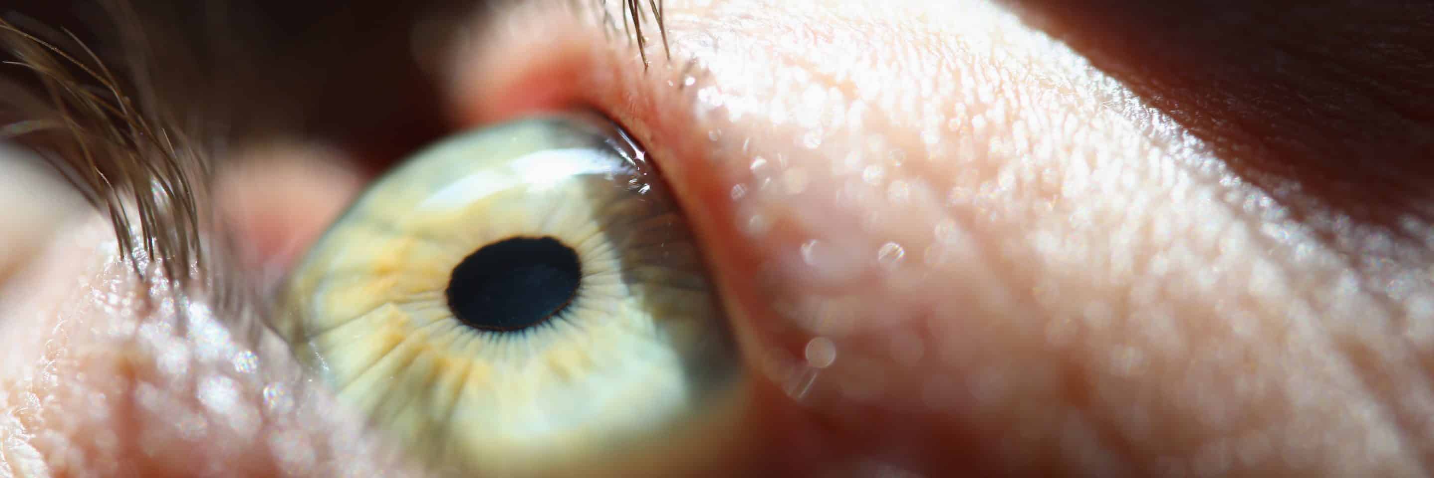 suplimentarea cu carotenoizi